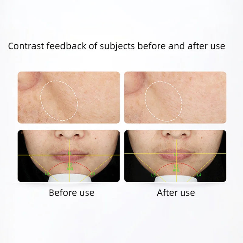 Murad Resurgence Retinol Youth Renewal Night Cream 50ml moisturizing, firming, anti-wrinkle, early aging and nourishing